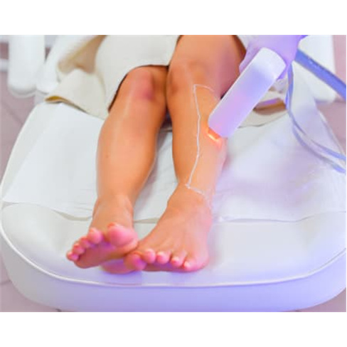 Pele Macia! Depilação Laser Díodo em Gaia | 3 Sessões Virilha, Axilas, Perna