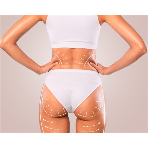 Corpo escultural: Diga adeus à gordura com EMSculpt na Nature Body, Telheiras.