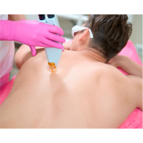 Depilação a Laser Díodo: Axilas, Perna e Virilha | Perfect Hair - Avenidas No