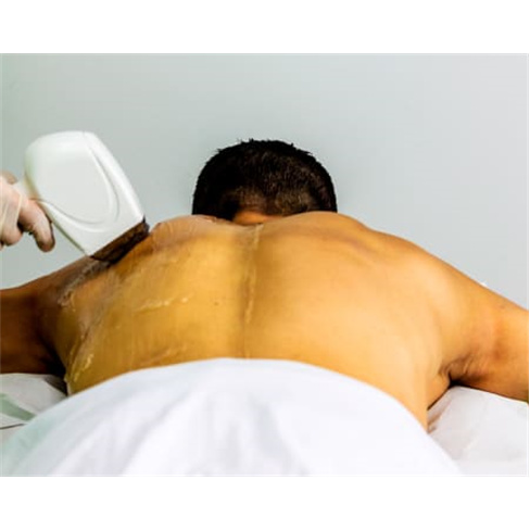 Depilação a Laser: 8 Locais - Perna Completa Homem. nCaracteres: 47.