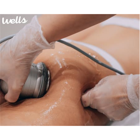 Pack Personalizado de Tratamentos de Corpo! 10 Sessões BodyStart | Wells Estét