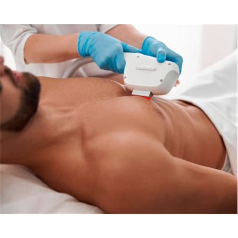 Depilação a Laser Díodo para Homem | Braga Axilas + Virilhas