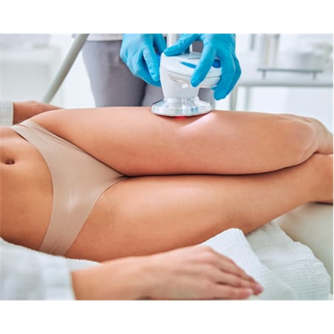 Criolipólise + Lipolaser | Oeiras