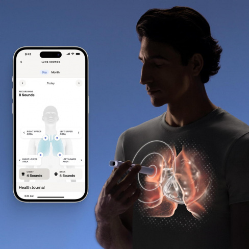 Withings - BeamO