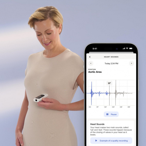 Withings - BeamO