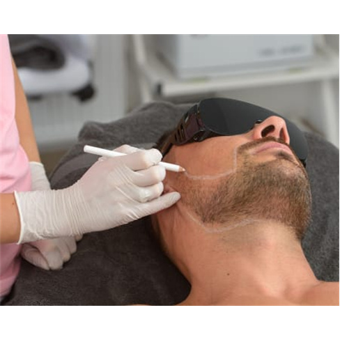 Depilação Laser Díodo: Sessão para Homens em Almada - Peitoral e Pernas