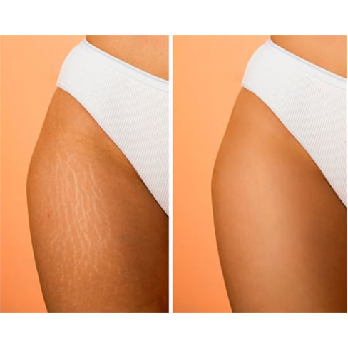 Tratamentos Corpo + Massagem | Soft Skin - AlgésnnTamanho: 38 caracteres.